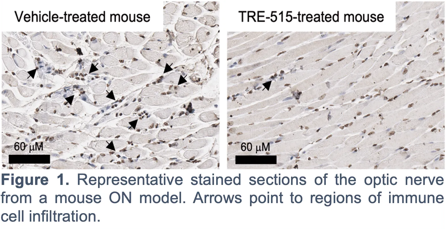 Two microscope images of optic nerve tissue from mice. The left shows more dark-stained regions (arrows) indicating immune cell infiltration; the right, from a TRE-515-treated mouse, shows fewer dark-stained regions. Scale bar: 60 μM.