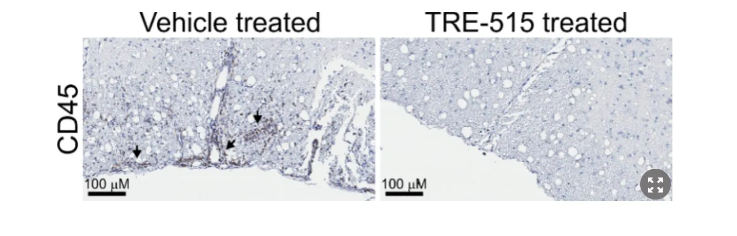 Two tissue images labeled Vehicle treated and TRE-515 treated show CD45 staining. The vehicle-treated sample has more dark-stained cells (arrows) than the TRE-515 treated sample. Both have a 100 μm scale bar.