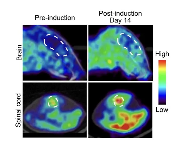 Four heatmap images show brain and spinal cord activity pre- and post-induction (Day 14). Color scale ranges from blue (low) to red (high). Brain activity increases post-induction.